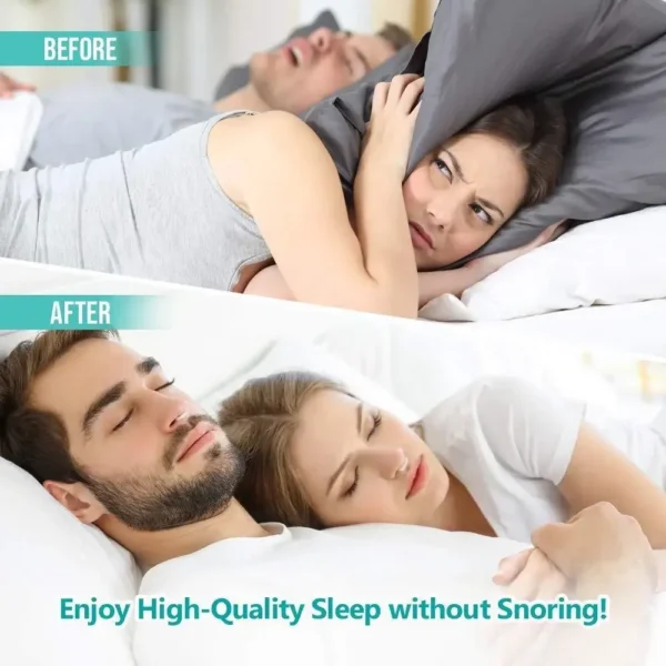 Anti-Snoring Corrector Snore Prevention Gadget - Image 2